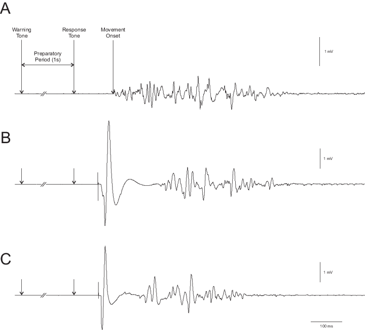 Electromyography Sample Record From The Biceps Brachii - Electromyography (720x650), Png Download