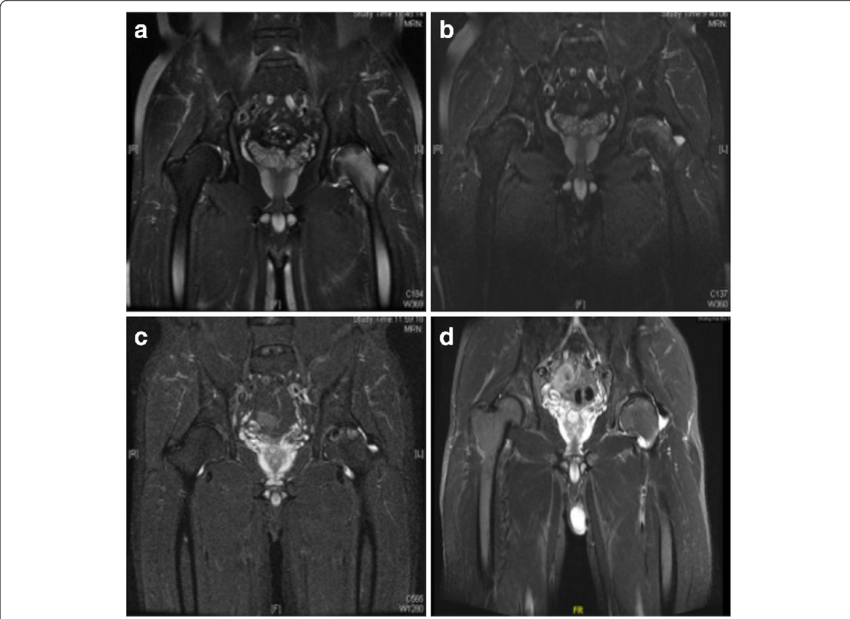 Mri Of A M - Common Fig (850x619), Png Download