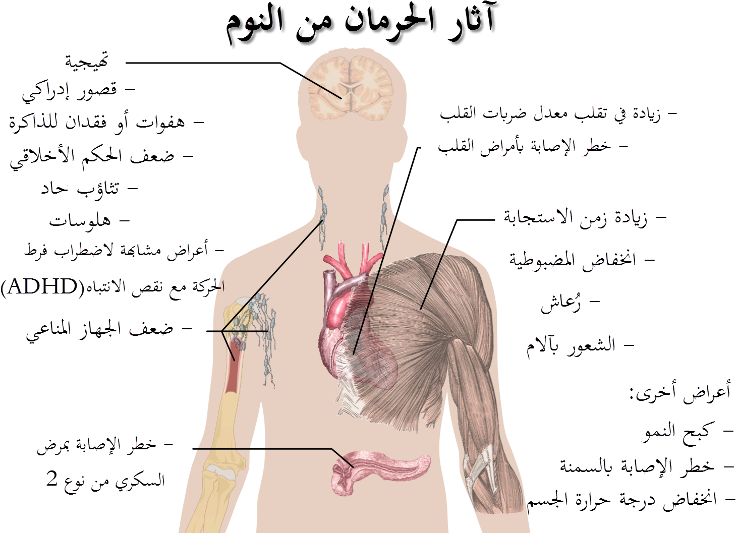 Effects Of Sleep Deprivation-ar - Healthy Lifestyle Is Important (1480x1090), Png Download