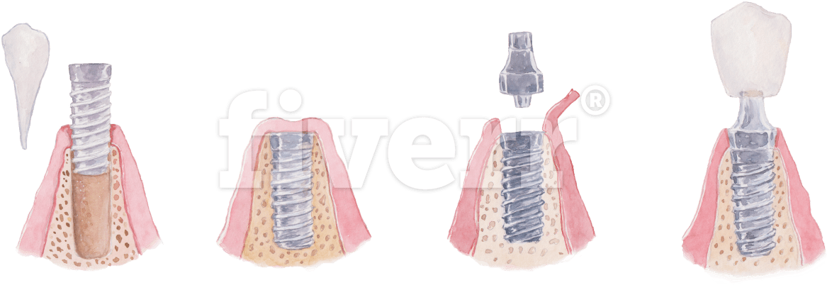 Accordion (1200x418), Png Download