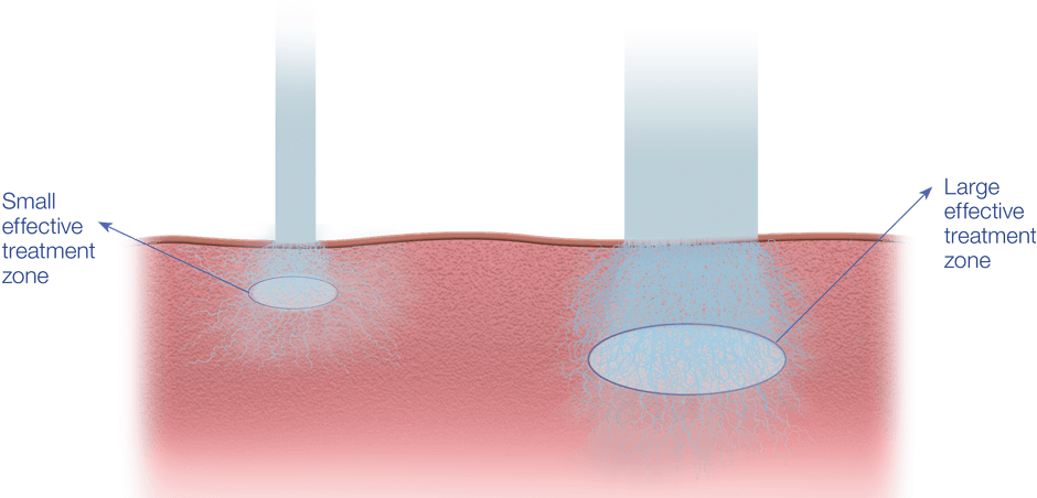 *brown, Mussarat, Hussain & Goldberg - Lampshade (960x453), Png Download