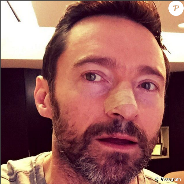 Hugh Jackman - Hugh Jackman Cancer Returns (950x601), Png Download