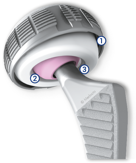 Articulation Liner/shell - Dual Mobility Pfanne (456x580), Png Download
