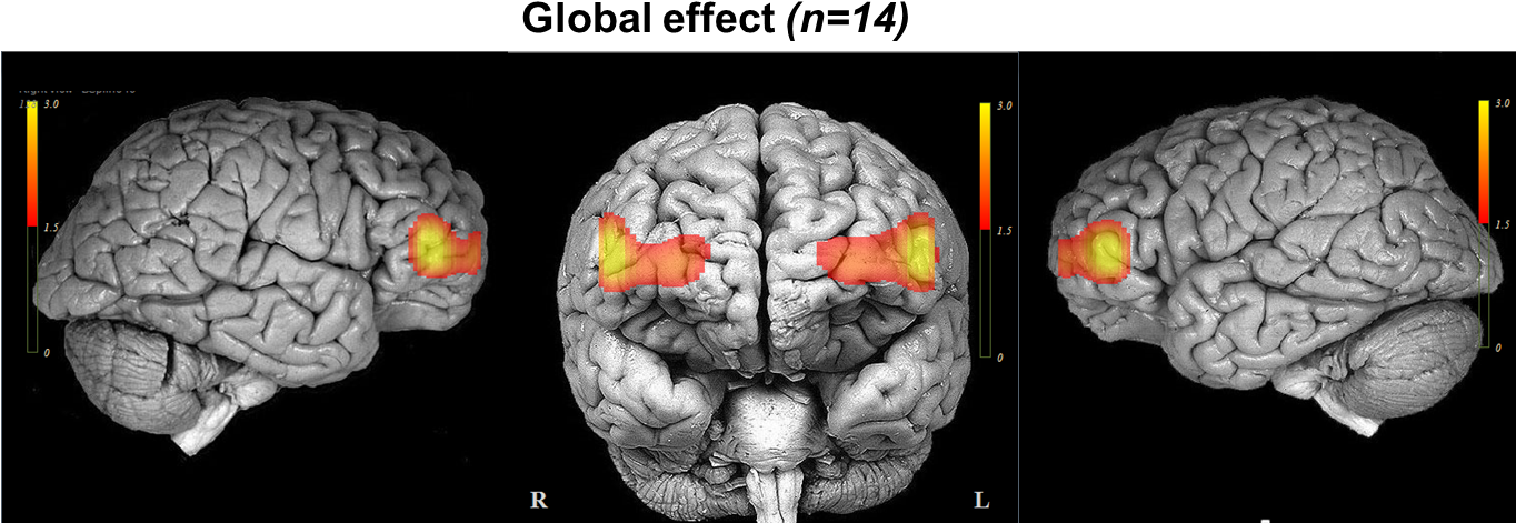 Our Approach Combines Cutting Edge Brain Imaging, Signal - Invitación A La Neurociencia [book] (1363x491), Png Download
