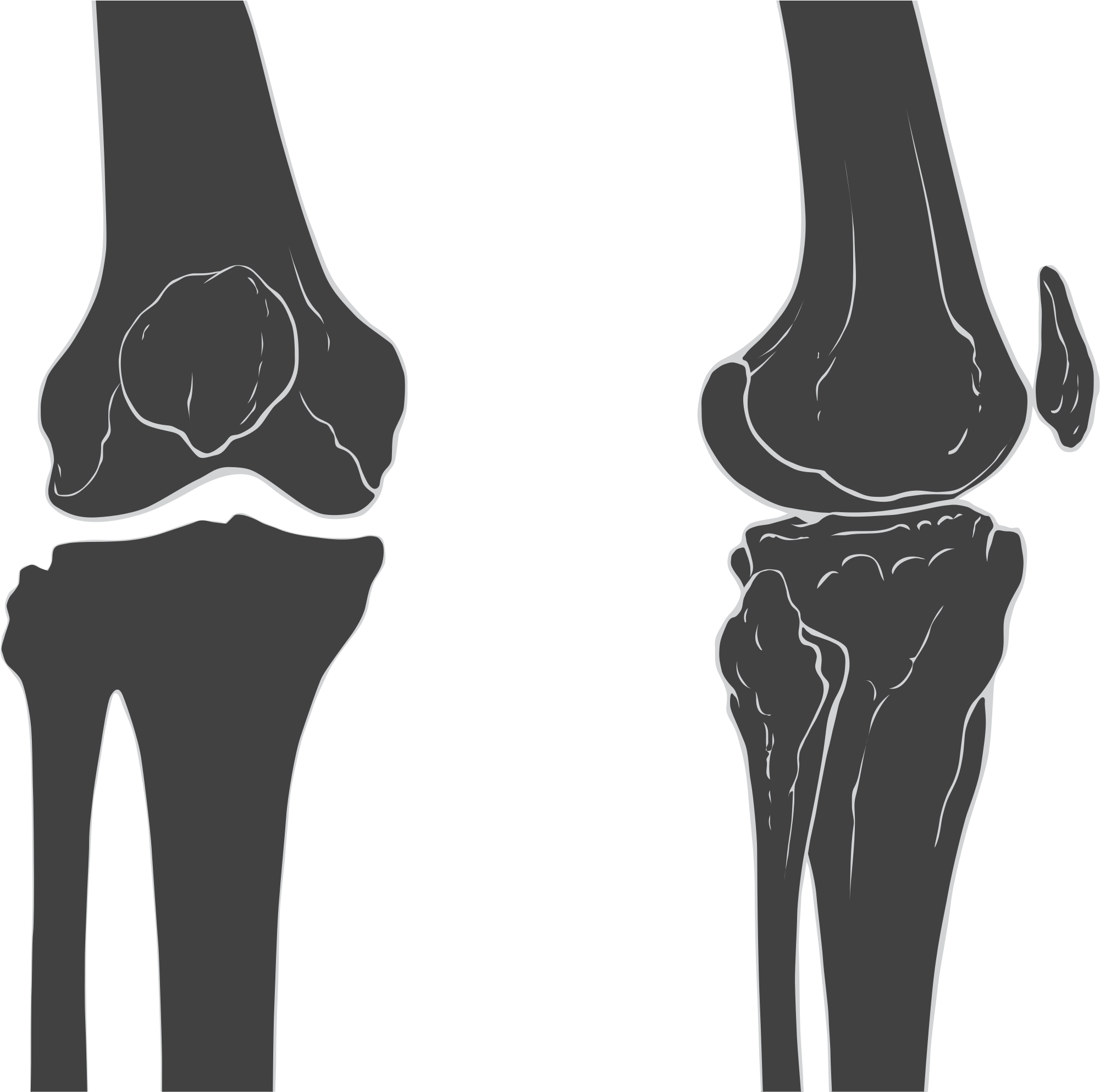 Open - Knee Skeleton (2000x2059), Png Download