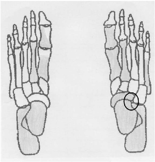 Preserved Foot Bones Of The Female Skeleton Labeled - Sketch (720x567), Png Download