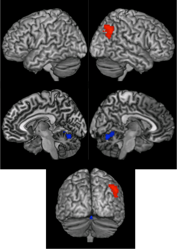 Results Of The Whole Brain Searchlight Analysis Showing - Perception Of Speech: From Sound To Meaning (581x816), Png Download