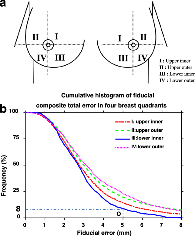 A Breast Quadrants - Quadrant Division (643x780), Png Download