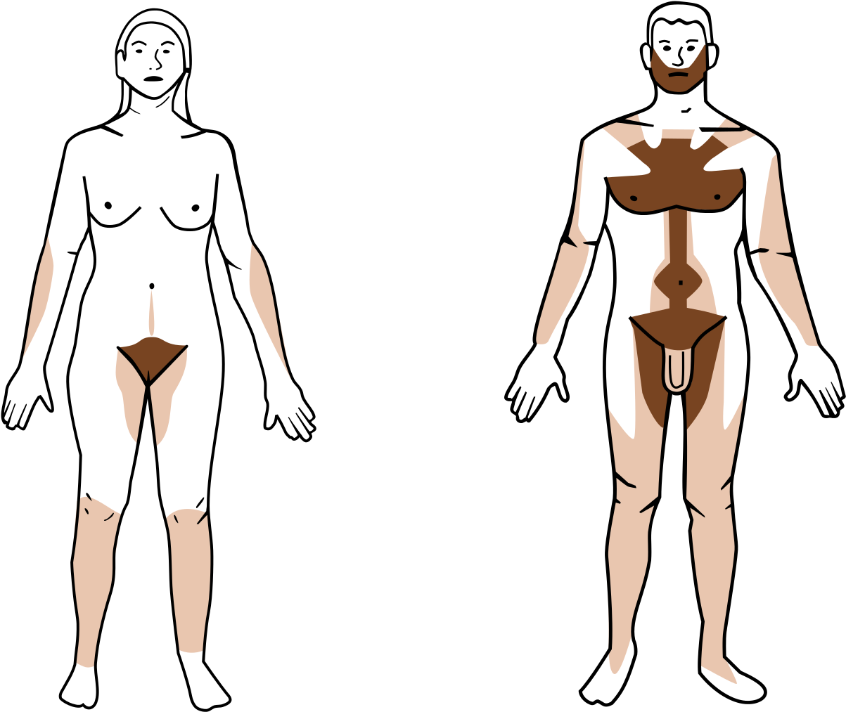 File - Androgenic Hair - Svg - Hair Removal (1251x1024), Png Download