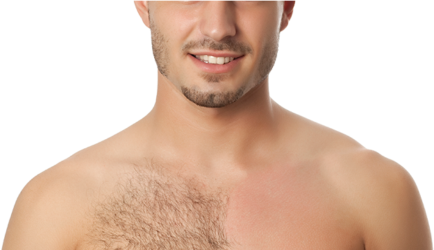 Male Chest Hair Png Clipart Royalty Free Library - Waxing Men (657x360), Png Download