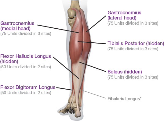 Posterior View - Lower Extremity Botox (578x413), Png Download