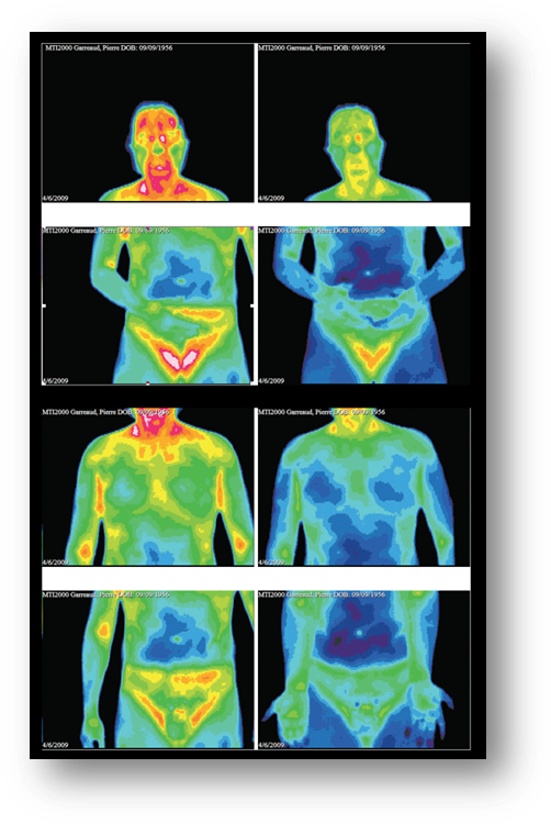 Before And After Taking Double Helix Water - Human Body Temperature (513x759), Png Download