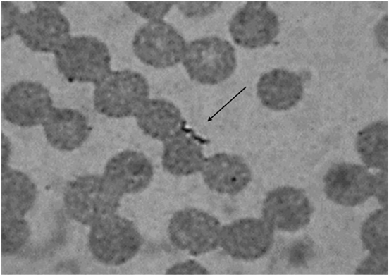 Leptospira In Blood - Leptospira Blood (903x389), Png Download