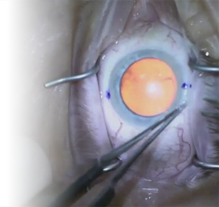 Visioncare Sumit Garg, Md - Painting (426x404), Png Download