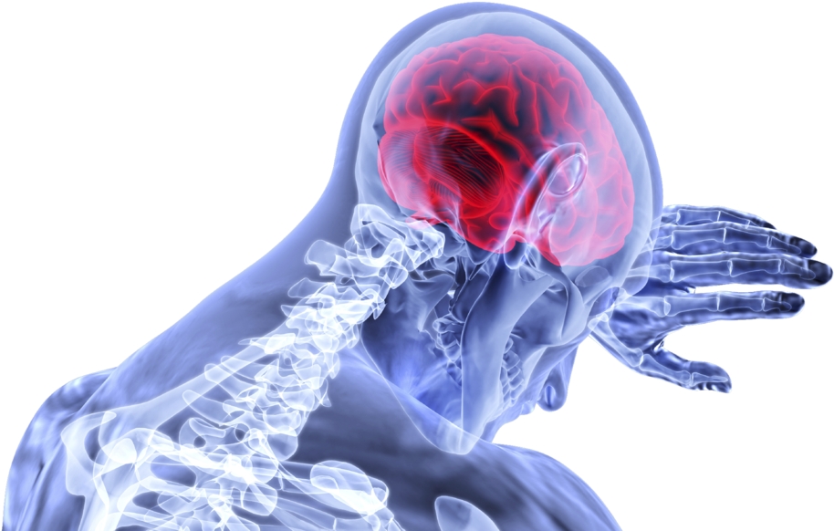 Brain, Inflammation, Stroke, Medical, Healthcare - Poškodbe Možganov (960x578), Png Download