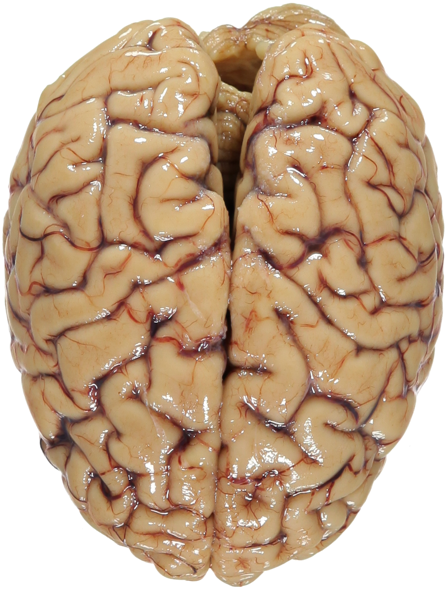 Human Brain Png Svg Free - Human Brain (909x1197), Png Download