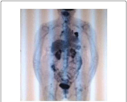 Follow Up Pet/ct Images In Transaxial And Multiple - Painting (513x413), Png Download