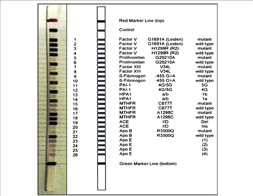 Design Of Cvd Strip Assay Test Used In The Current - Cvd Strip Assay (850x659), Png Download