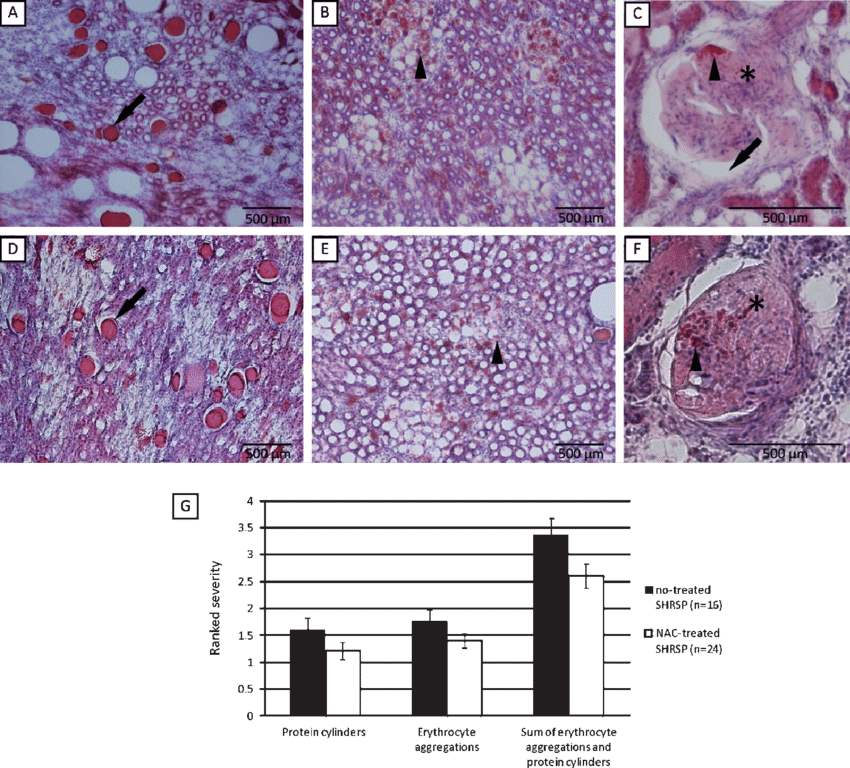 Kidney Pathology In No-treated Shrsp And In Shrsp Under - Secretion (850x768), Png Download