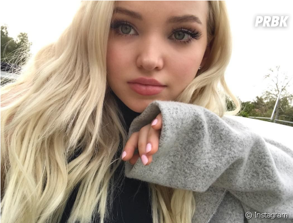 Dove Cameron De "descendentes" Conta Que Gostaria De - Dove Cameron With Freckles (624x600), Png Download