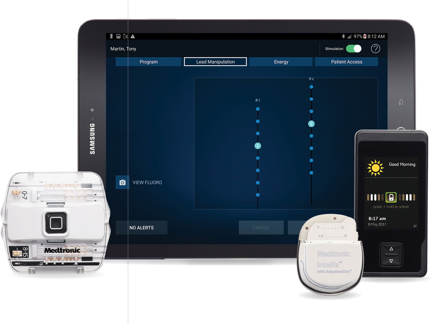 Medtronic Plc Has Announced Fda Approval And Usa Launch - Medtronic Intellis (1631x1125), Png Download