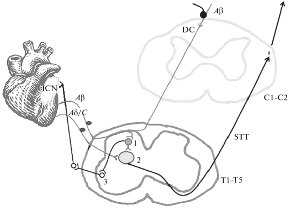 The Scheme Of Effects Of The Spinal Cord Electrical - Spinal Cord (850x446), Png Download