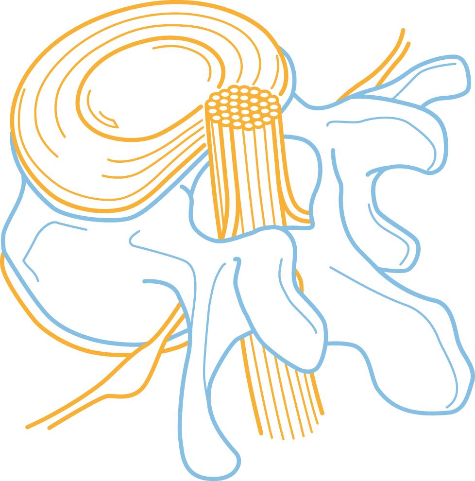 Spinal Cord Injury Centre - Balgrist University Hospital (978x990), Png Download