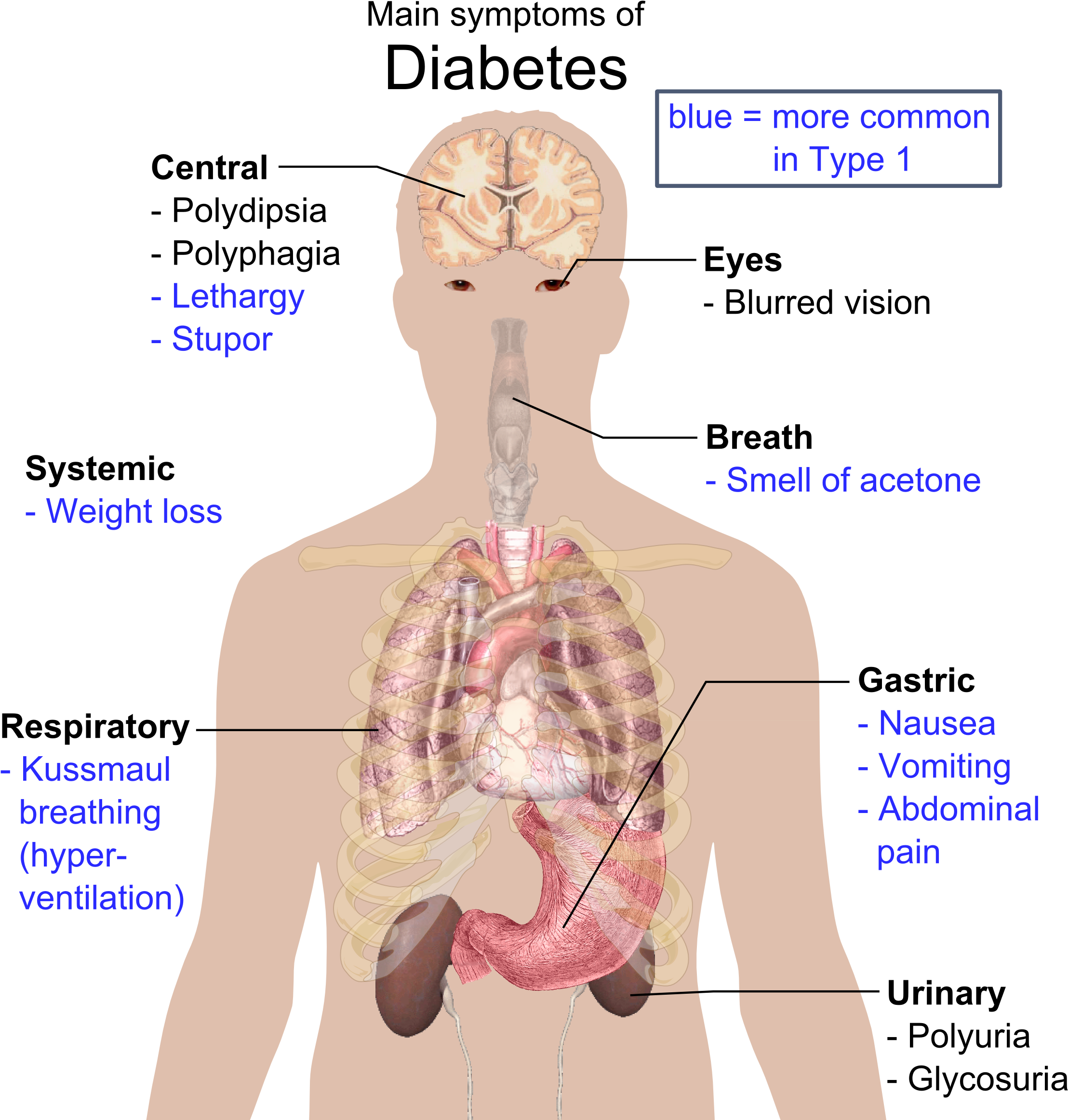 Main Symptoms Of Diabetes (2286x2338), Png Download