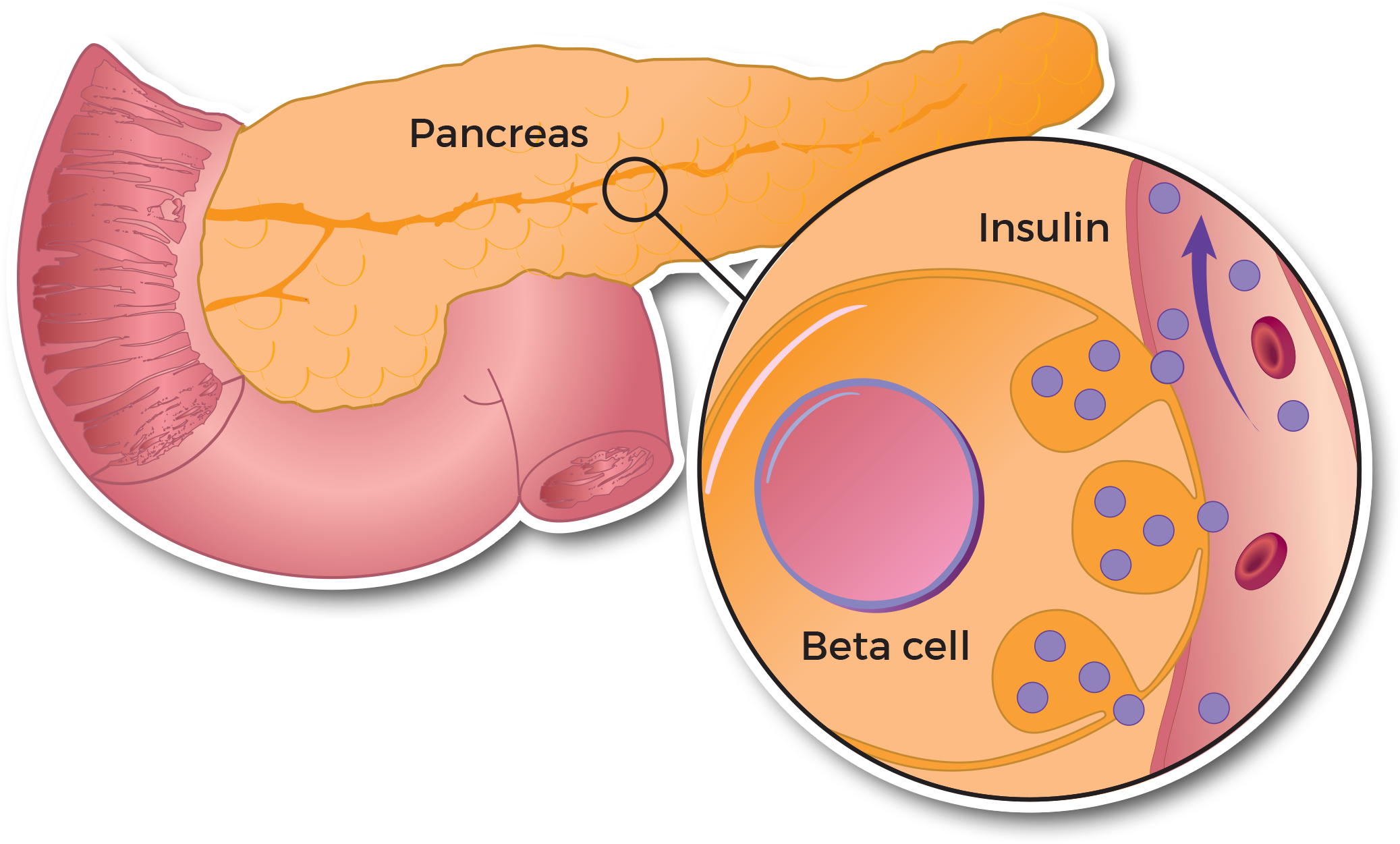 About Diabetes - Diabetes Mellitus (2100x1350), Png Download