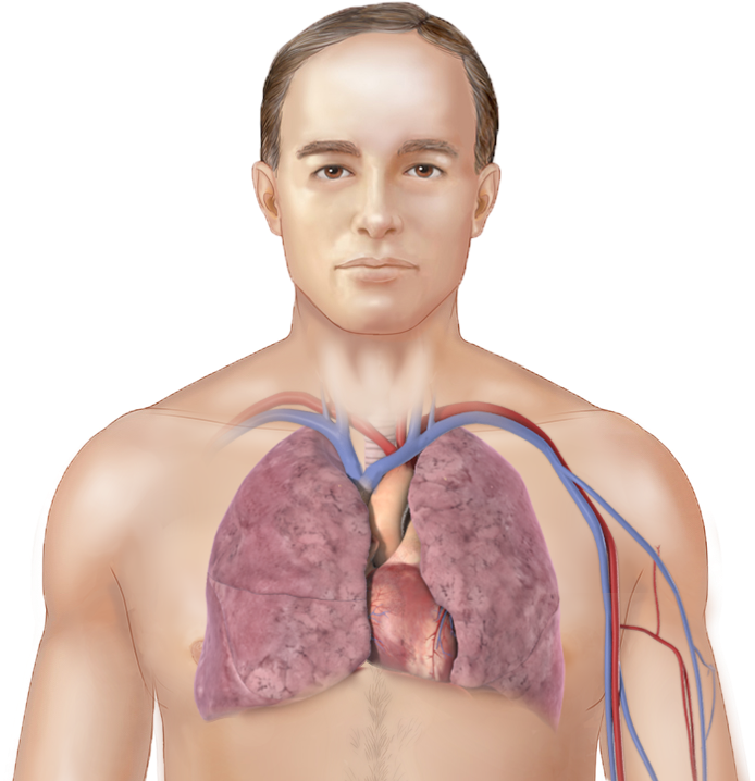 What Is Pulmonary Fibrosis - Meat (712x728), Png Download