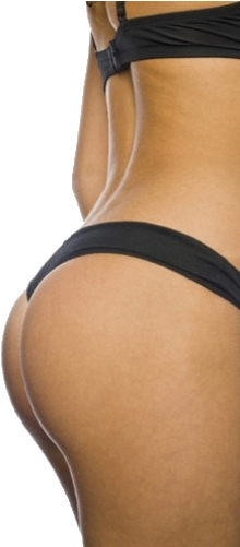 Brazilian Butt Lift - Buttocks Png (275x500), Png Download