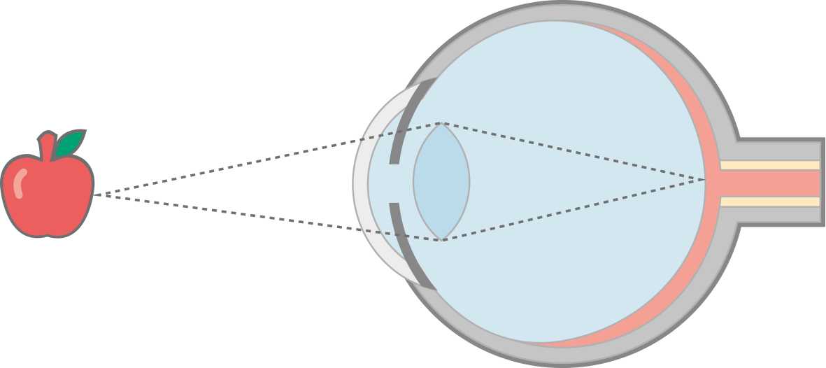 Fig1 In Focus Final - Portable Network Graphics (1181x526), Png Download