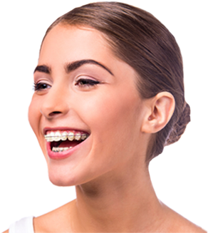 Treating Faces, Designing Smiles - Special Offer For Braces (489x399), Png Download
