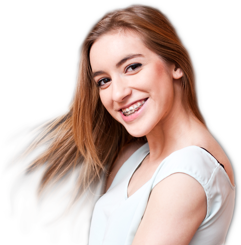 Braces Smile (800x815), Png Download