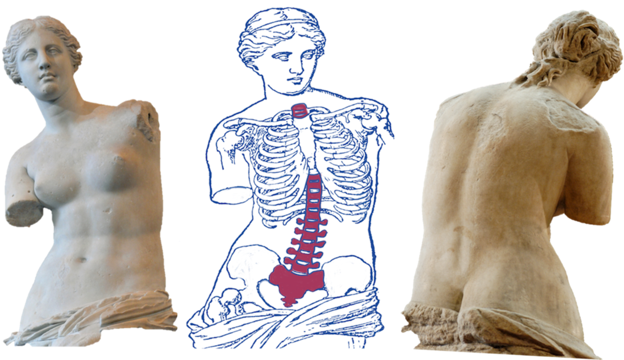 Anterior View Of The Venus De Milo - Bone Health And Osteoporosis: A Report (2000x1151), Png Download