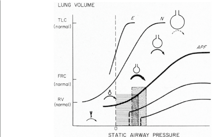 Use Of The Pressure/volume Curve To Personalize Peep - Cartoon (850x446), Png Download