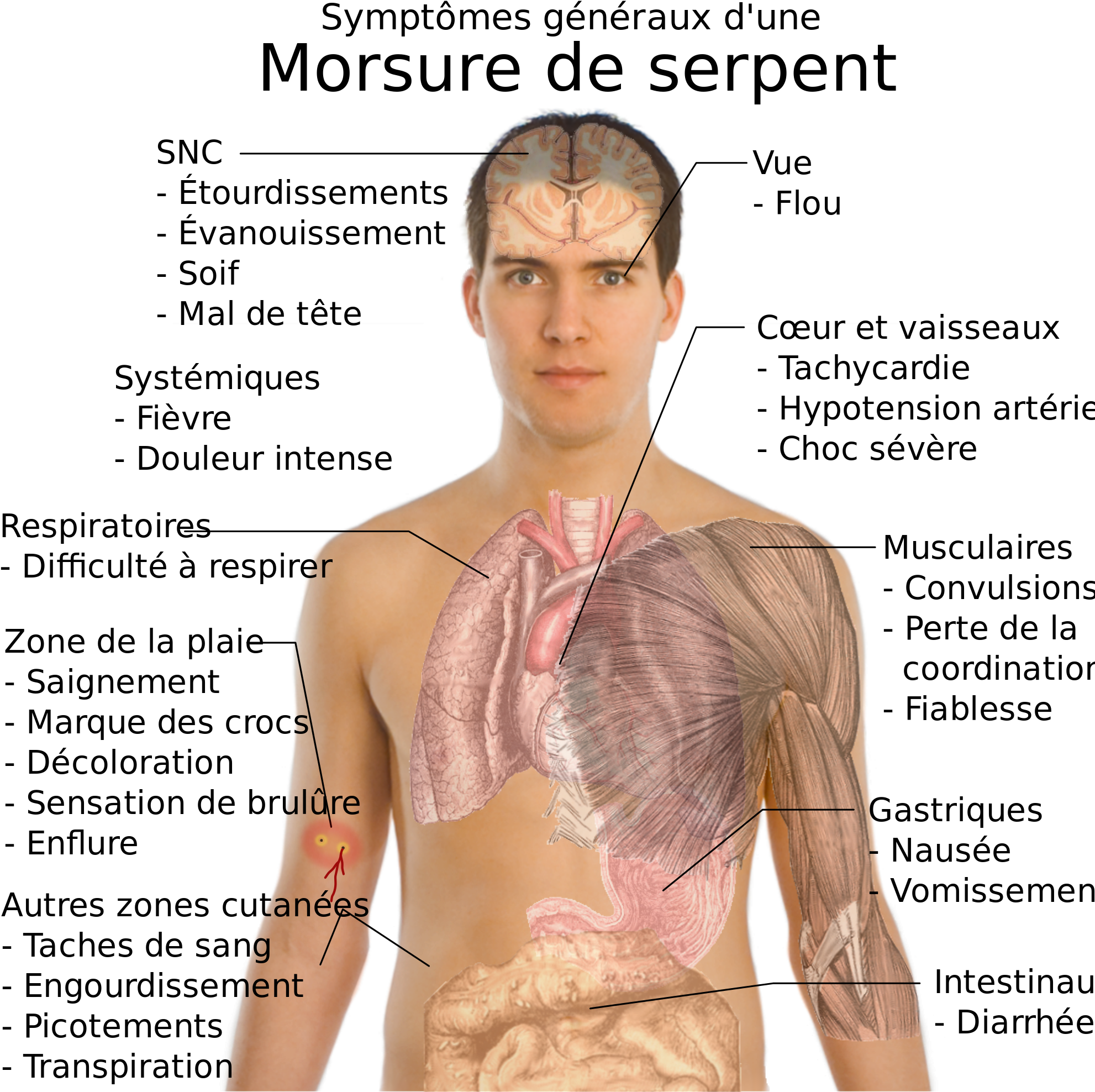 Open - Tramadol Addiction (2000x1989), Png Download