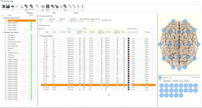 In-home Video Eeg And Ltm Monitoring - Natural Therapies For Parkinson's Disease By Laurie (800x600), Png Download
