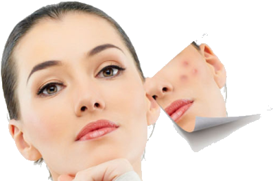 How To Get Rid Of Sunspots - Veluxio Naturals Best Blackhead Remover And Comedone (459x266), Png Download