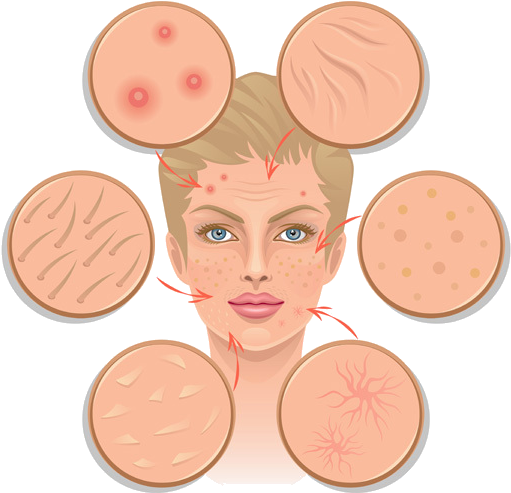 Treat Acne Scars - Face Skin Concerns (570x570), Png Download