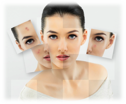 Break Free From Acne - Blackhead And Pimple Remover Kit - Instructions Included (432x357), Png Download