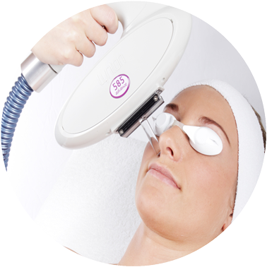 How Does Ipl Treatment Reduce Ance - Circle (430x430), Png Download
