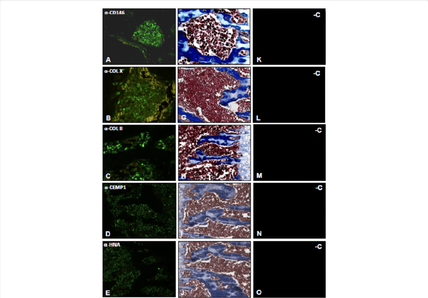 At 14 Days Cells Located In The Vicinity Of Bone And - Tissue (850x591), Png Download