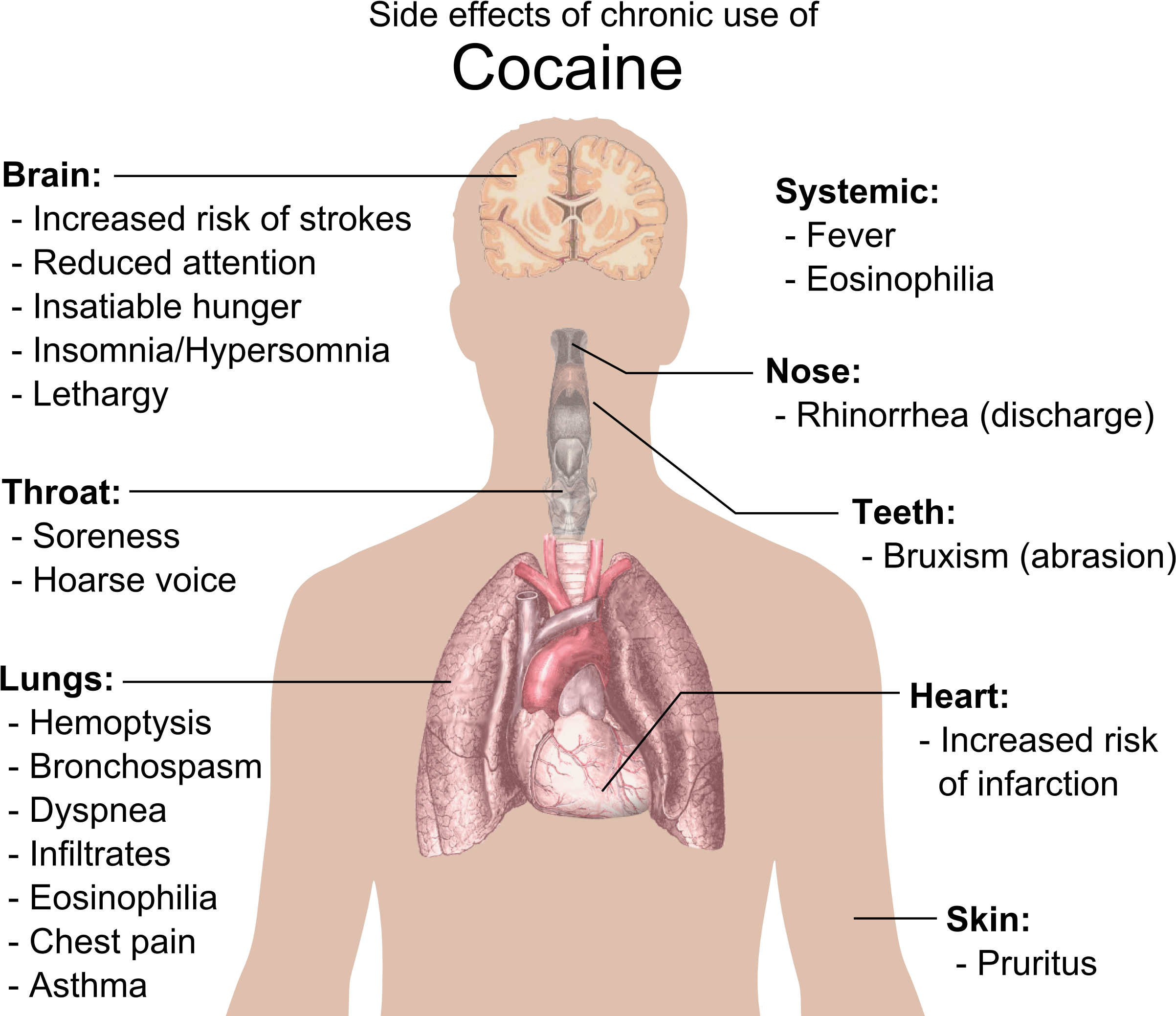Side Effects Of Chronic Use Of Cocaine - Cocaine Side Effects (2493x2098), Png Download