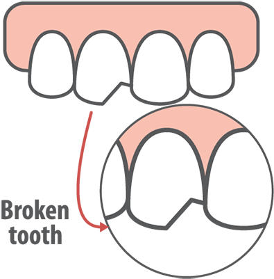 What Is A Dental Emergency (500x448), Png Download