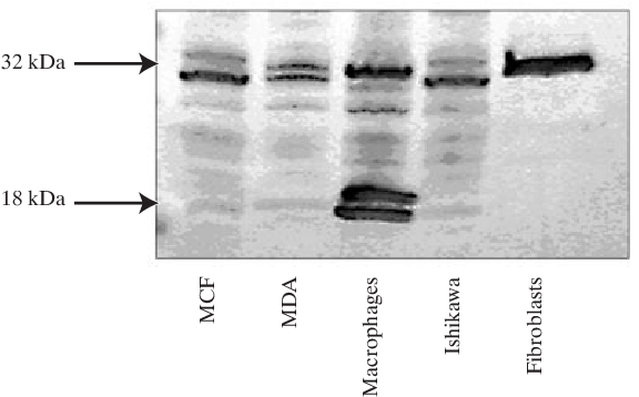 Western Immunoblot Analysis For Pbr In Different Neoplastic - Composite Material (592x373), Png Download