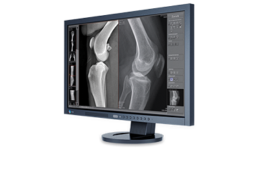 Or Technology's Dicompacs® Diagnostic Software Is Designed - Radiography (413x300), Png Download