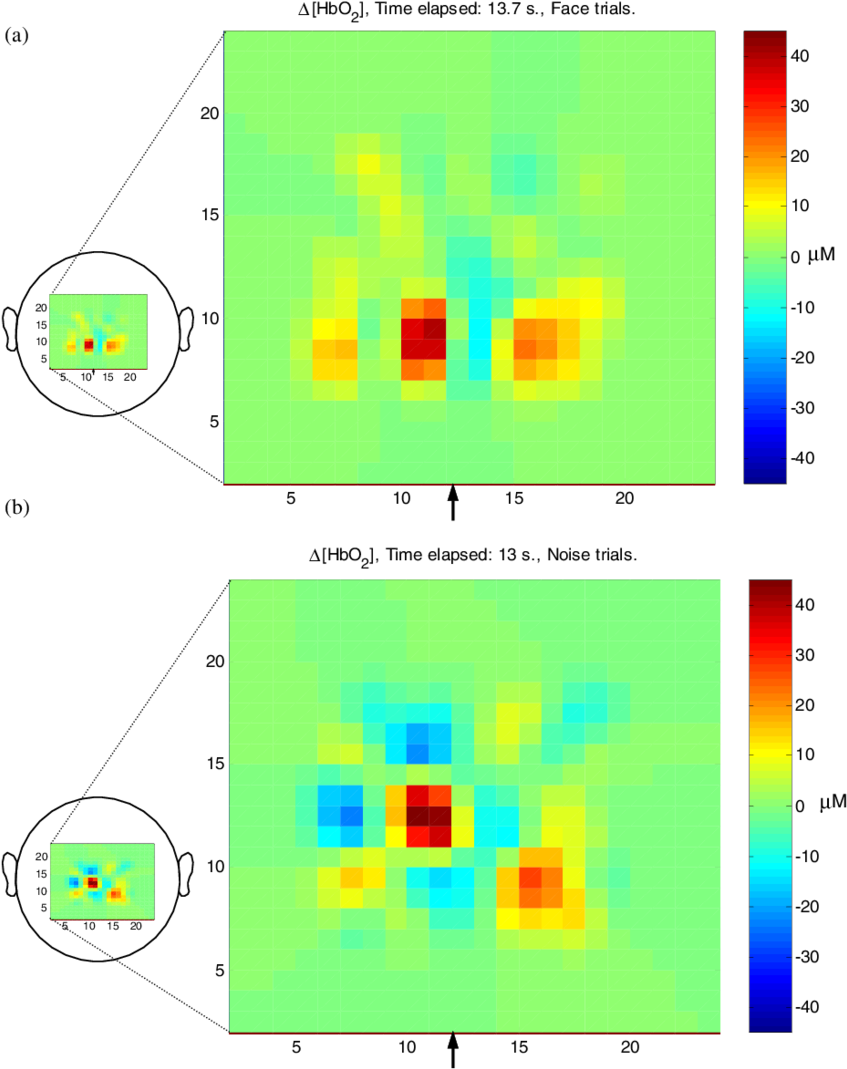 Reconstruction Of Baby A's Optical Topography Data - Diagram (850x1075), Png Download