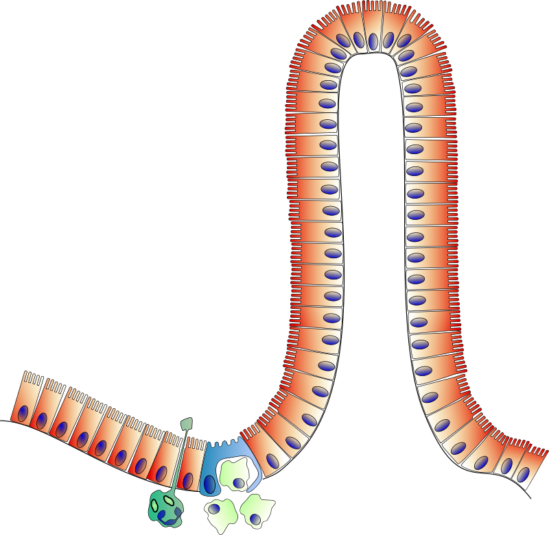 Peyer S Patch - Peyer's Patches Clipart (800x781), Png Download