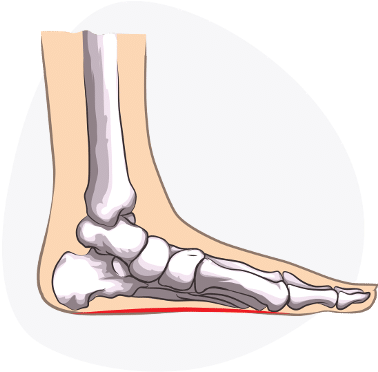 My Program Made Use Of This Old-school Wisdon, Combined - Straight Feet Problem (400x397), Png Download